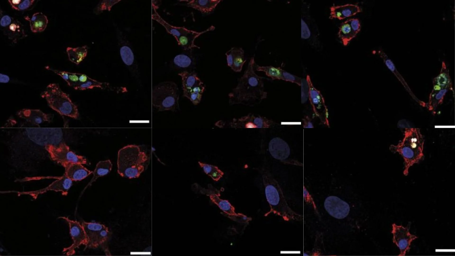 Microscope images show red and blue stained macrophages engulf senescent cells (fluorescent green)